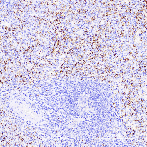 CD61 Antibody Reagent for Immunohistochemistry